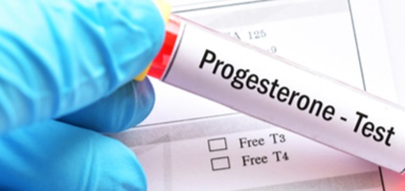 בדיקת פרוגסטרון (Progesterone) - תמונה